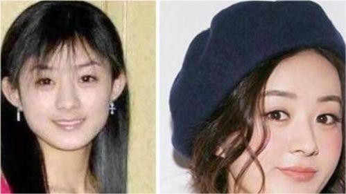 娱乐圈整过容的女星,整容女星华丽蜕变之路